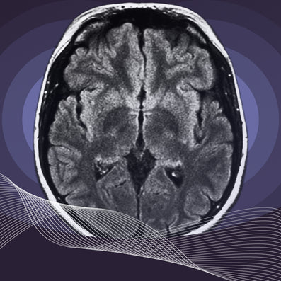 White matter in the brain: The key to synchrony