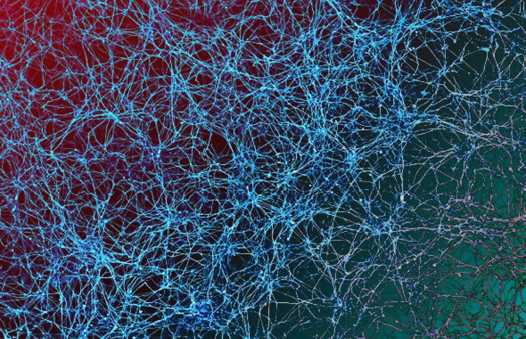 Neuroplasticity