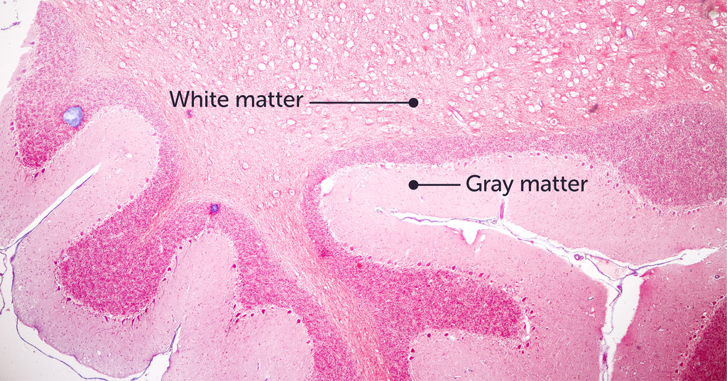 White matter vs gray matter